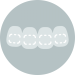 ortodoncia-invisible